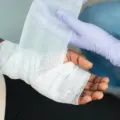 Advanced Therapies for Chronic Wounds