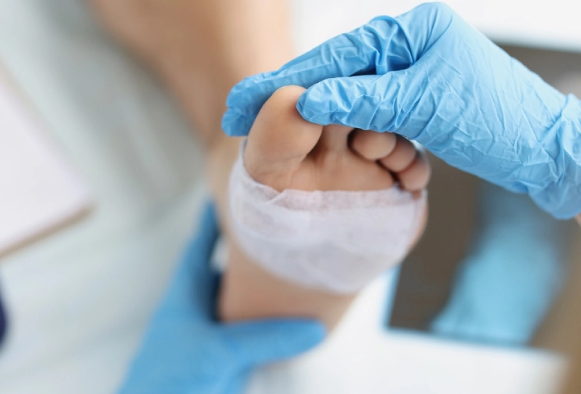 Surgical Wounds